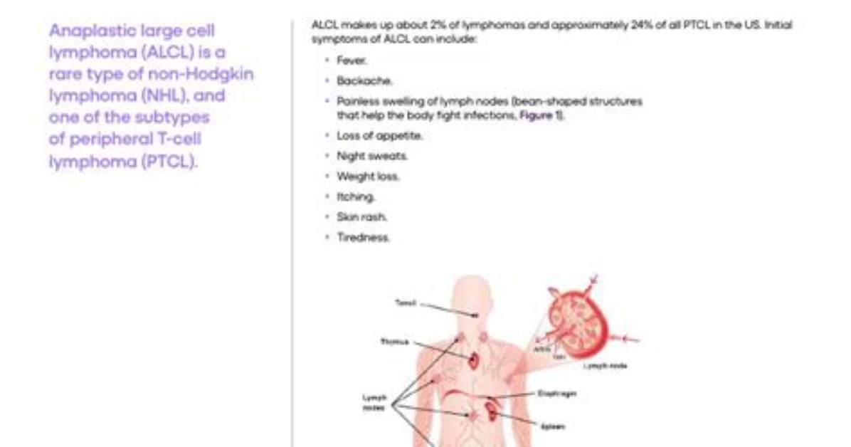 What Is Angioimmunoblastic T-Cell Lymphoma? Jurassic Park Actor Sam Neill Being Treated for Stage-Three Blood Cancer
