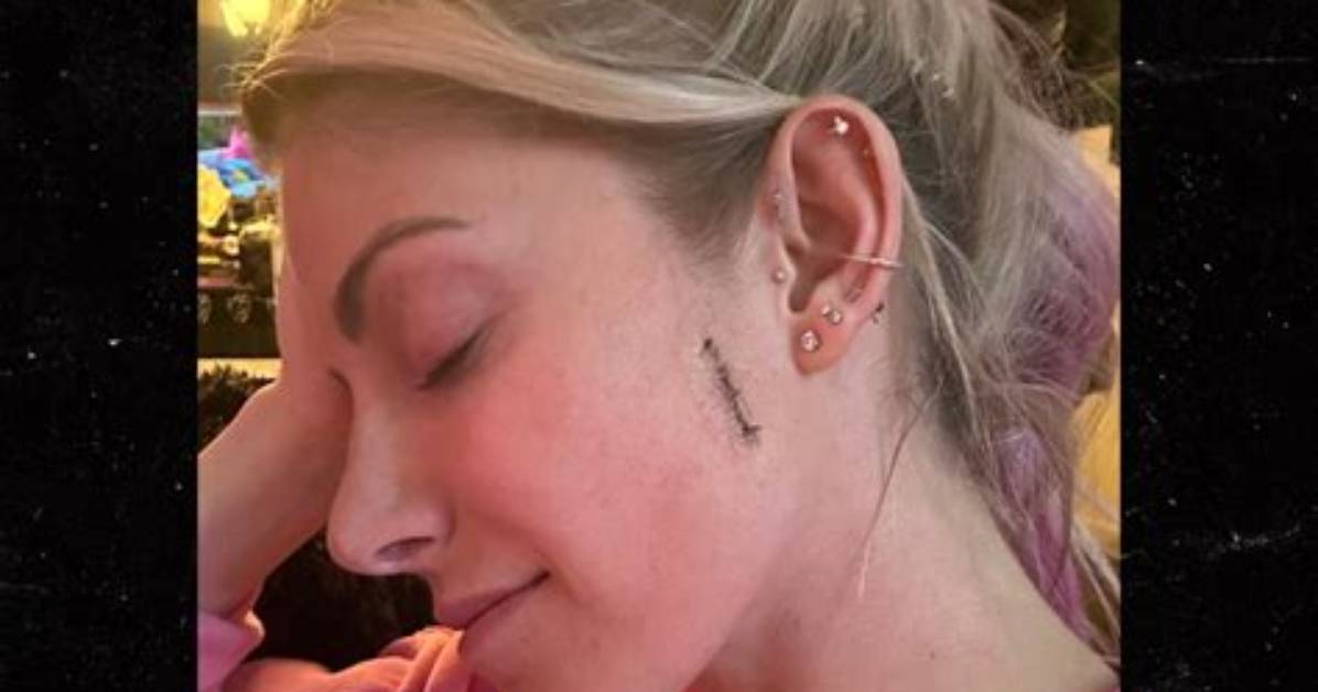 Wwe Superstar Alexa Bliss Reveals Skin Cancer Diagnosis, Is ‘All Clear’ After Treatment