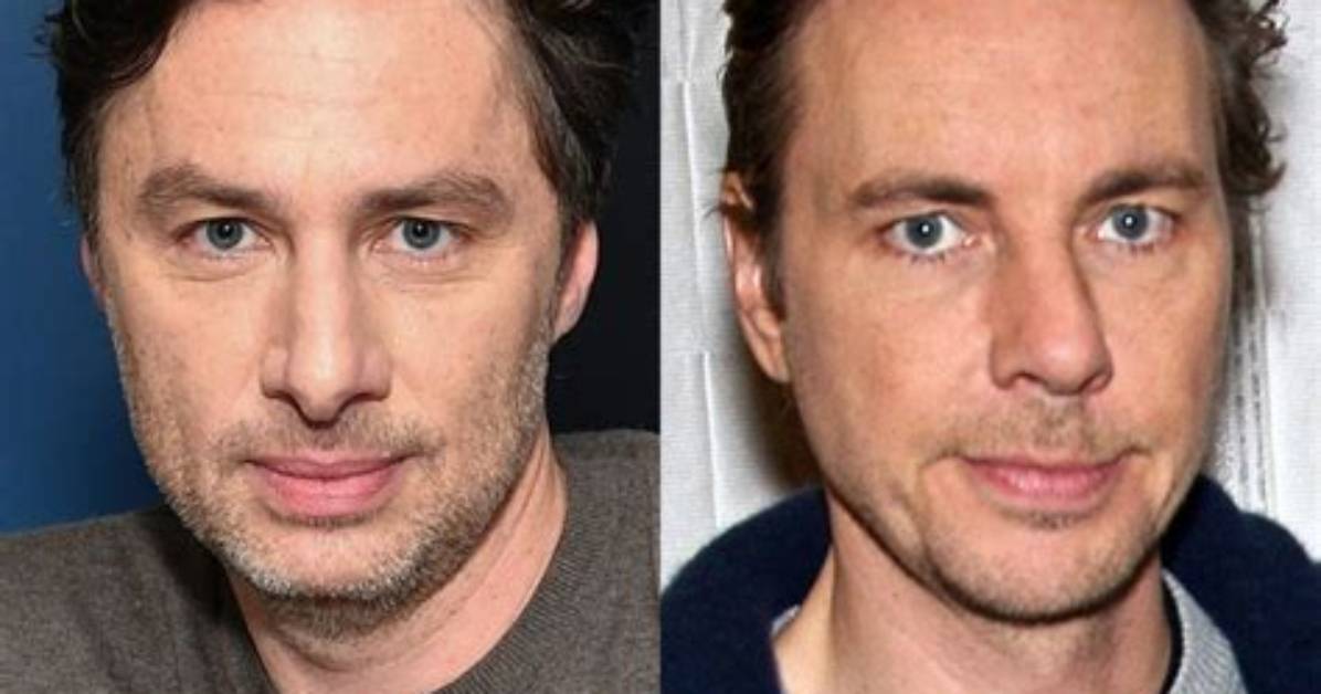 Zach Braff's Face Lift: Ageless Looks, Enhanced Confidence